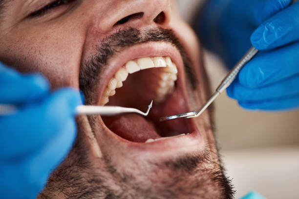 Dentist for Dental Trauma in WI